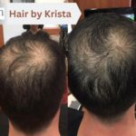 Results from the best product for male hair loss by Krista at FOR MEN Salon and Spa in Lake Forest, California.