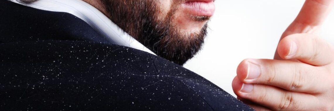 Dandruff shampoo can help stop embarrassing flakes. Call FOR MEN Salon and Spa in Lake Forest for the best products for men today.