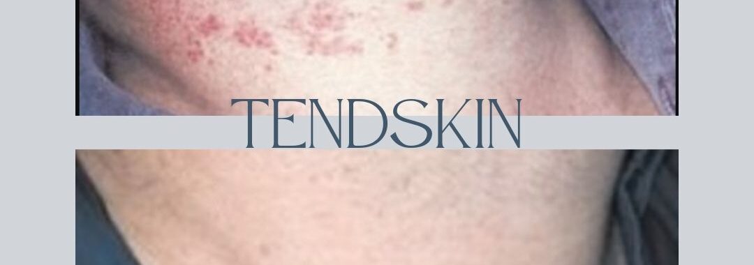 Male waxing near me at FOR MEN Salon and Spa recommends TendSkin for at home post wax treatment of ingrown hairs.