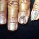 Nail care done by professionals can help with early detection of health related issues that nails expose.