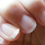 Nail care performed regularly can help prevent dry and brittle nails.