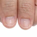 Nail care when done properly can expose health issues that fingernails tell us.