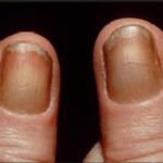 Nail Care done routinely can help rectify yellowed nails