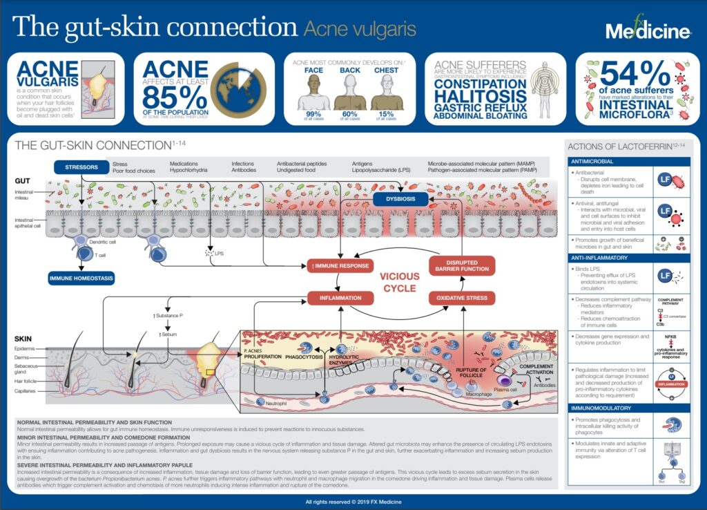 Gut Health Infograph by fx Medicine AU