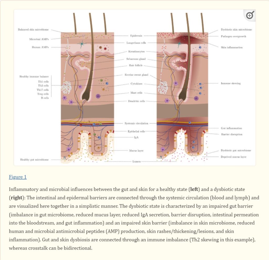 Gut-Hair axis by the Library of Medicine