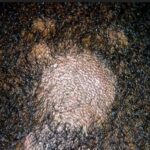 Scalp ringworm can be spotted by a master hairstylist who will recommend the client see a medical professional.